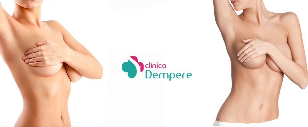 Mamoplastia
